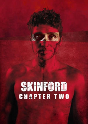 Skinford: Chapter Two