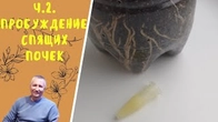 ч. 2. Пробуждение спящих почек.