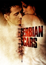 Serbian Scars